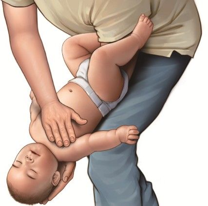 영아 가슴 밀어내기(한 손 손꿈치 압박법). 질병청 제공